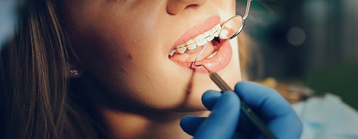 Cómo pueden los odontólogos reducir el riesgo de procesos legales